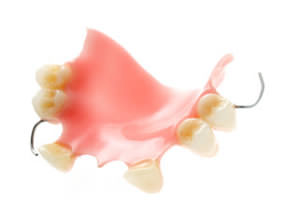 Removable partial dentures restore a person’s natural appearance and greatly improve the ability to chew and speak clearly.